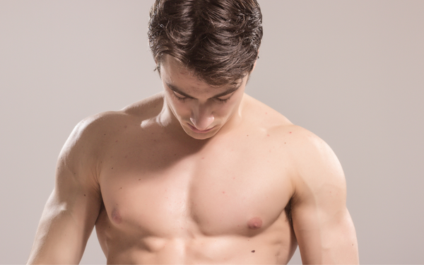 Gynecomastia